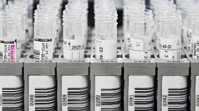 157 нови случая на COVID-19 у нас, почти два пъти повече са излекуваните