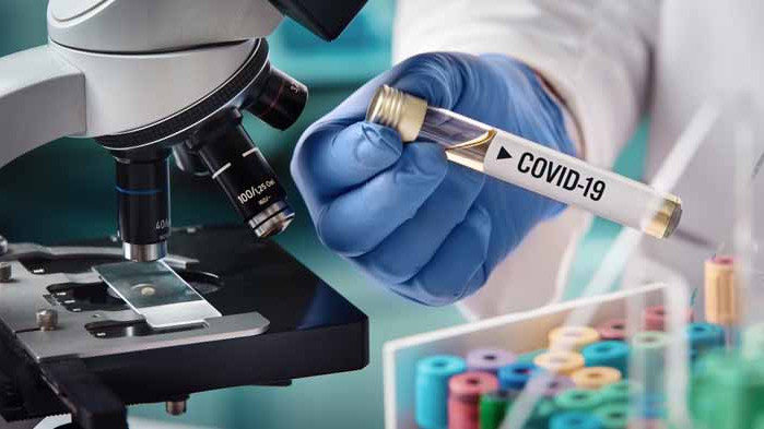 Точно колкото вчера и днес 157 нови случая на COVID-19 у нас