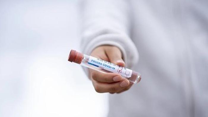 Над 100 нови заразени с коронавируса в Сърбия, двама са починали
