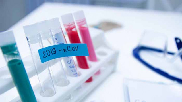 99 нови случая на COVID-19 у нас