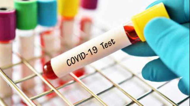 26 нови случая на COVID-19 у нас