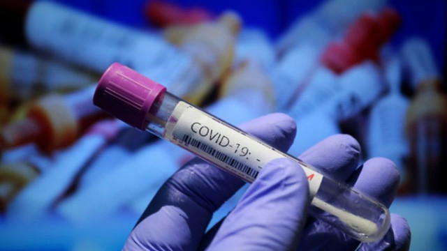 25 са новите случаи на COVID-19