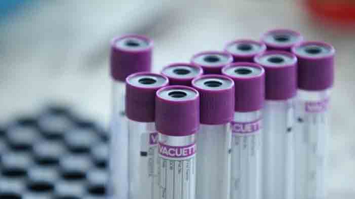 Затвориха ясла в Сливен заради деца, контактни на заразени с COVID-19