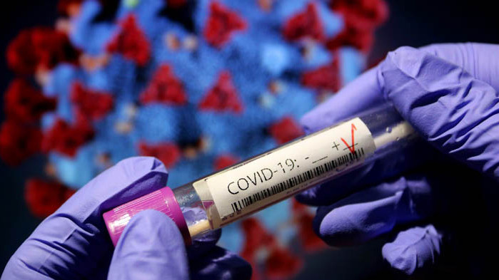 Нови 125 заразени c COVID-19 в Северна Македония за последното денонощие