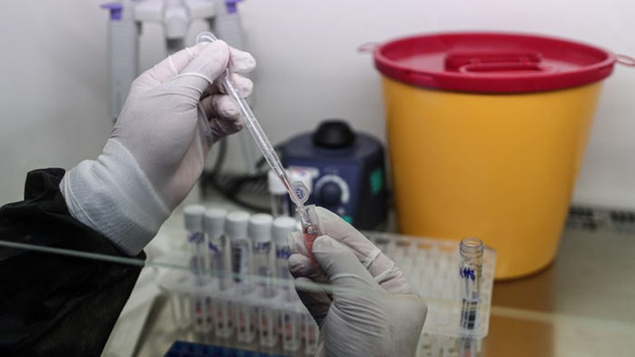 43 са случаите на COVID-19, потвърдени у нас през последното денонощие