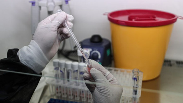 43 са случаите на COVID-19, потвърдени у нас през последното денонощие