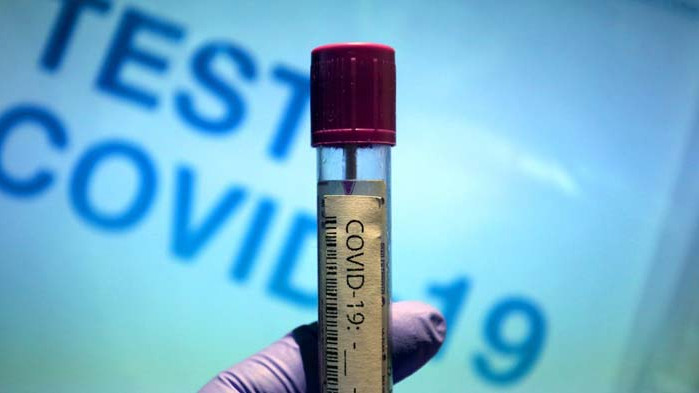 САЩ с милиони дози от бъдеща COVID-ваксина, Европа бърза, за да не остане с празни ръце