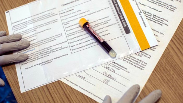 48 са общо заразените с коронавирус в Сърница