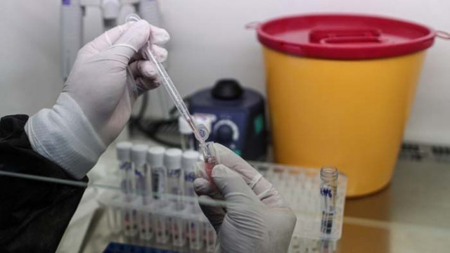 Почина фелдшерът с COVID-19, от когото плъзна заразата в Каолиново