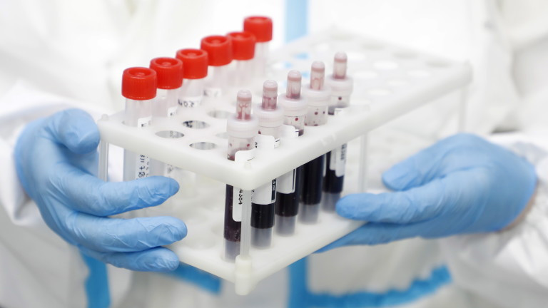 В Панагюрище под карантина е цяла група забавачка заради дете с COVID-19