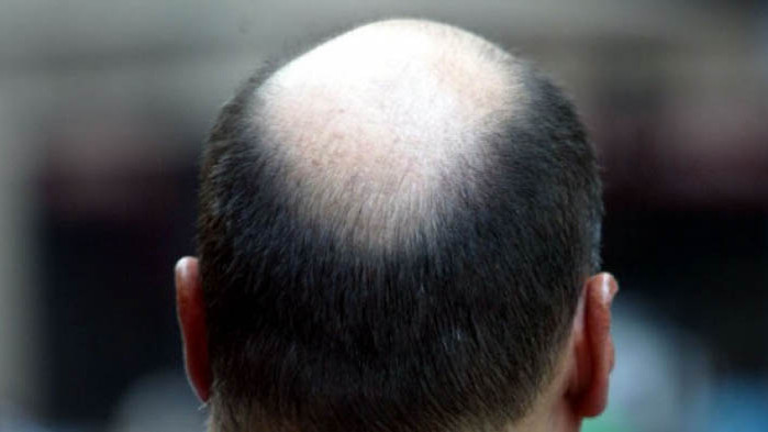 Защо плешивите мъже остават интимни по-дълго