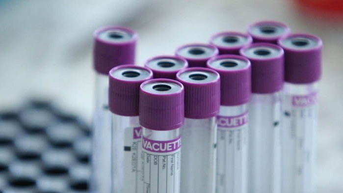 Бързите тестове за COVID-19 на завърналите се от кланица в Германия българи са отрицателни