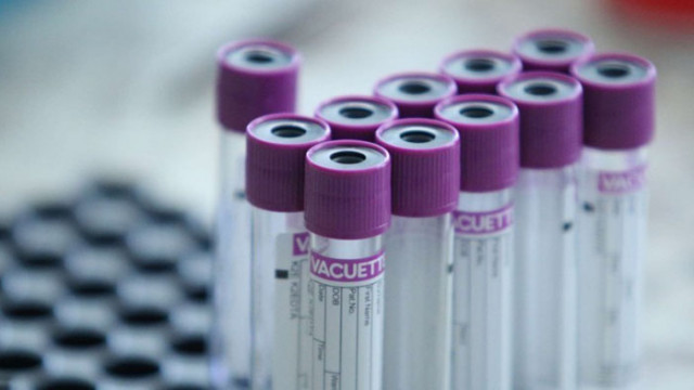 Временно затварят Община Враца заради посетител с COVID-19