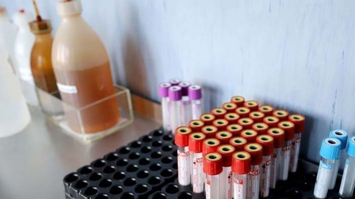 Двама българи от кланицата в германския град Гютерсло са в болница с COVID-19