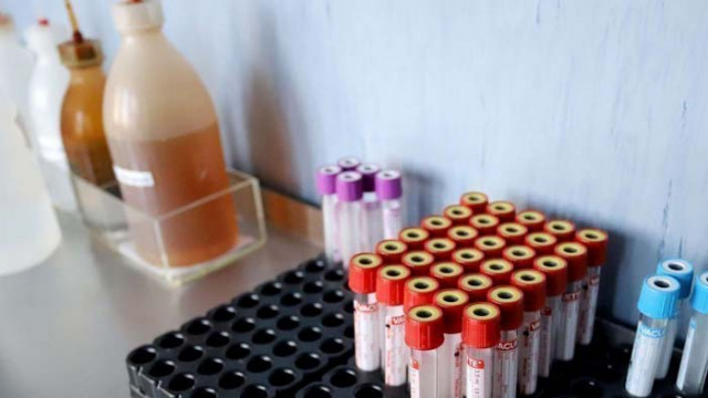 Двама българи от кланицата в германския град Гютерсло са в болница с COVID-19