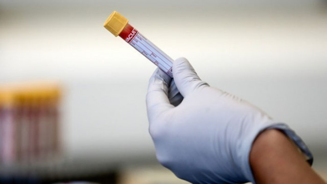 Председателката на сръбския парламент хоспитализирана с COVID-19