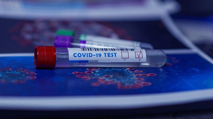 10 нови случая на COVID-19 във Варна, общо за страната са 66