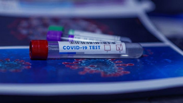 10 нови случая на COVID-19 във Варна, общо за страната са 66