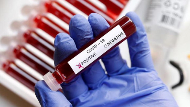 7 починали през денонощието и 158 нови случая на COVID-19 у нас