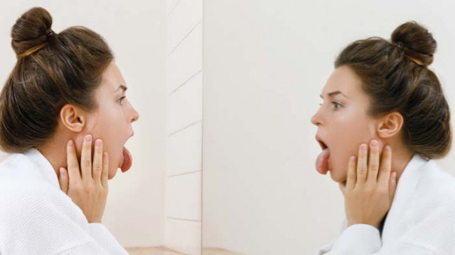 Здравословни проблеми, които си личат по състоянието на езика