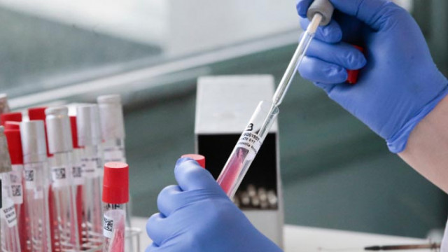 Отново рекорд: 182 нови случая на COVID-19 у нас. Седем са починалите