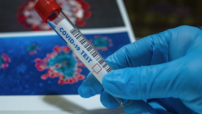 Нов случай на COVID-19 в Русе