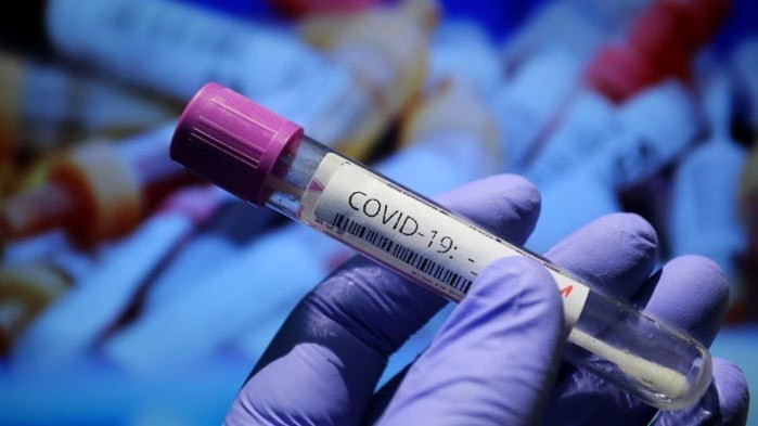 Шестима служители от „Криминална полиция“ в Пловдив са с COVID-19