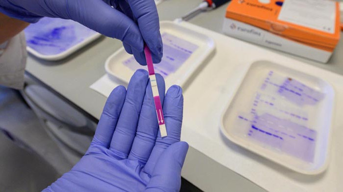 Делнично: 174 нови случая на COVID-19