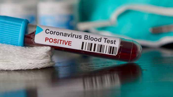 12 футболисти от пернишкия „Миньор” са с коронавирус