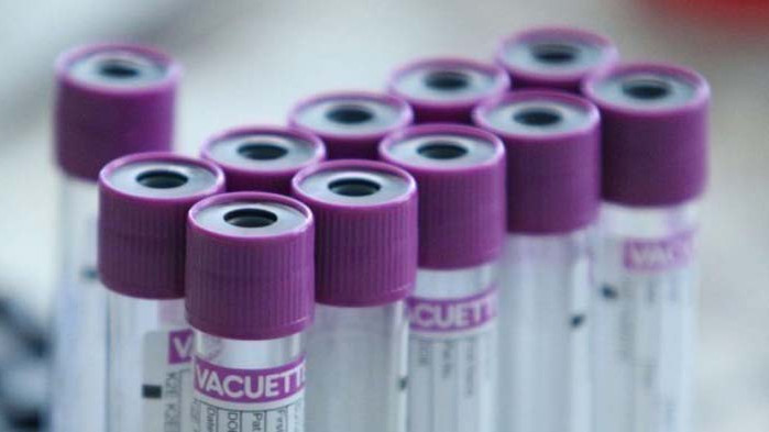 Четиримесечно бебе е с коронавирус в болницата в Смолян