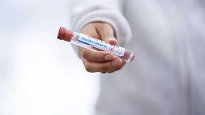 Над 100 новозаразени с COVID-19 за трети пореден ден в Чехия