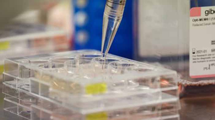 159 нови случая на COVID-19 у нас. Почти 200 са излекуваните за последното денонощие