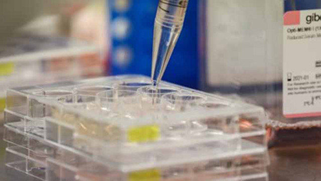 159 нови случая на COVID-19 у нас. Почти 200 са излекуваните за последното денонощие