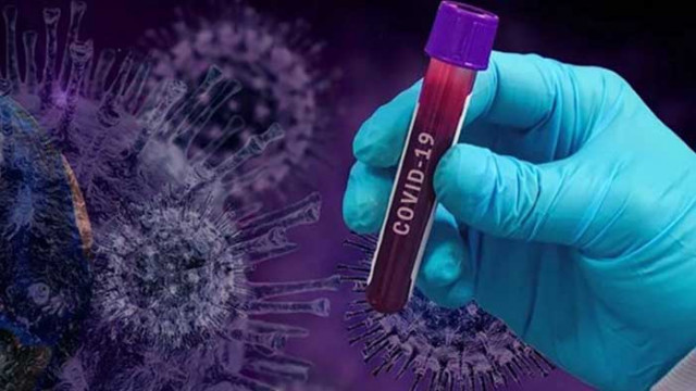 Нови 196 случая на COVID-19 у нас