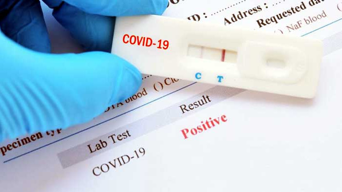 Три нови случая на COVID-19 и шестима излекувани за последното денонощие в област Русе