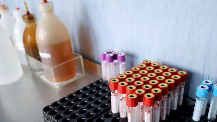 САЩ с над 1 000 починали от коронавируса за втори пореден ден