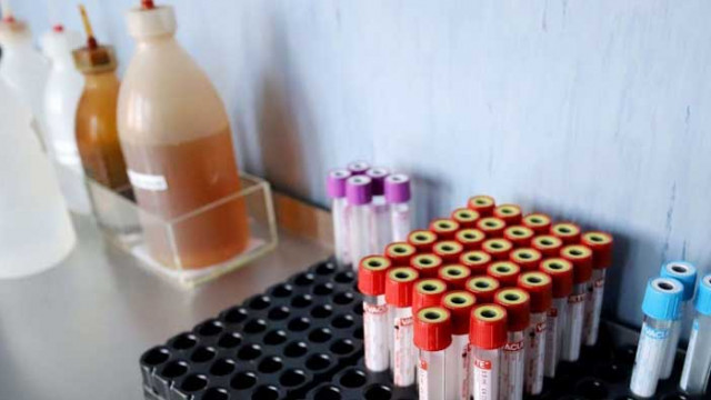 САЩ с над 1 000 починали от коронавируса за втори пореден ден