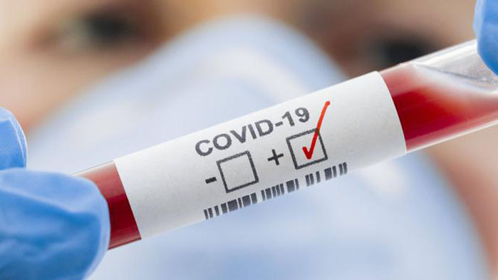 Мерки по повод установени случаи на COVID - 19  на територията на община Ямбол