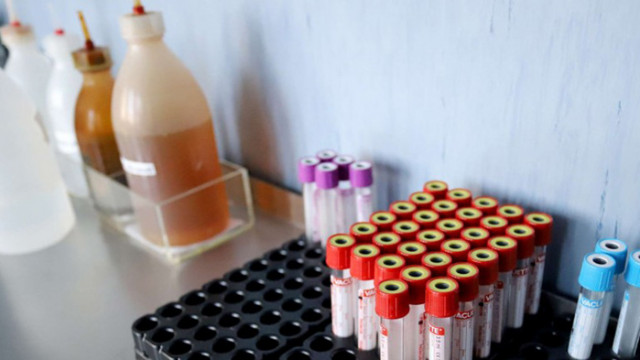 Единственият лекар в рудоземското село Чепинци е с COVID-19