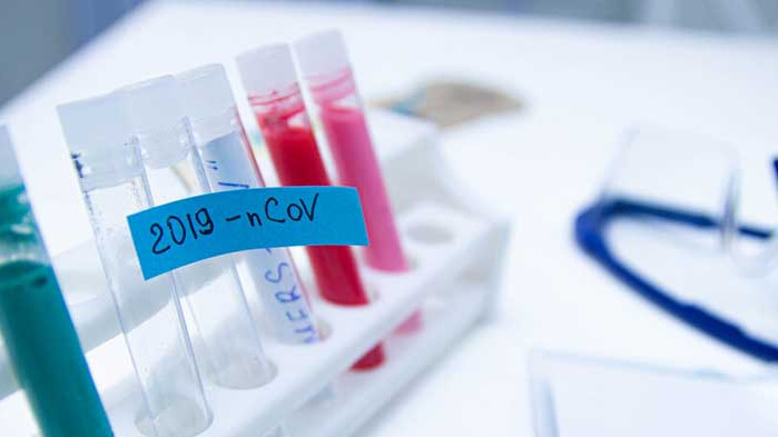 13 починали през последното денонощие, нови 284 са диагностицирани с COVID-19