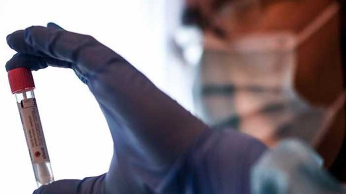 Антирекорди без край: 16 починали през денонощието и нови 204 с COVID-19