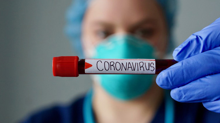 Броят на жертвите от COVID-19 в света надхвърли 700 000