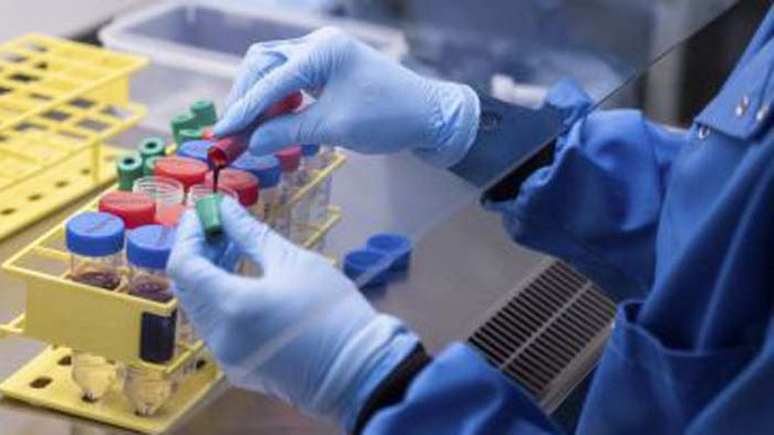 Отново над 300 случая на COVID-19 у нас