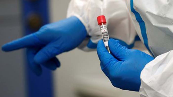 Десетки новозаразени с COVID-19 в Словакия