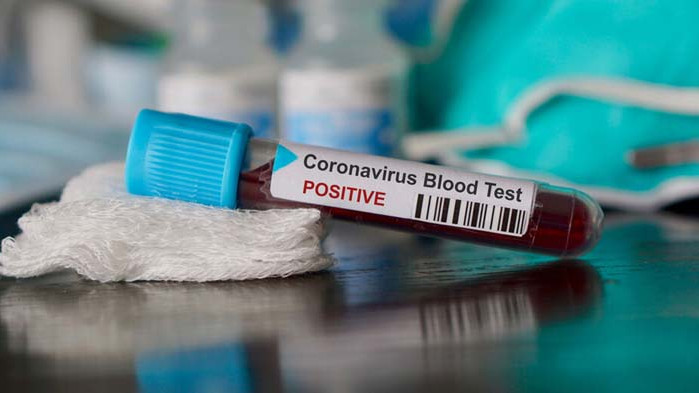 Преминахме  границата от 13 000 заразени, 297 са новите случаи на COVID-19