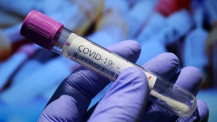 COVID-19: Почина шофьор на линейка от Благоевград