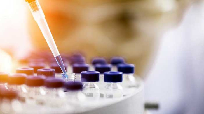 116 нови случая на COVID-19 у нас