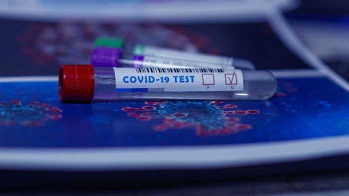 171 нови случая на COVID-19 у нас, голям брой и на излекуваните