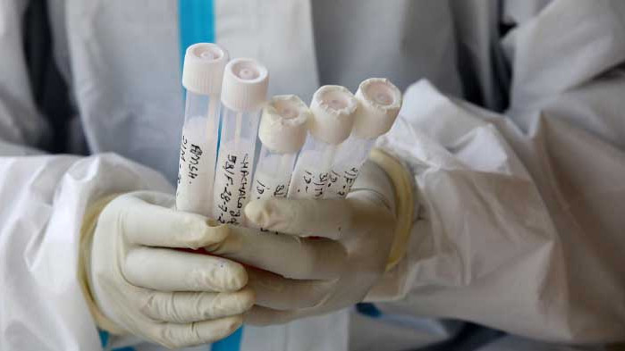 422-ма излекувани за последното денонощие и нови 176 случая на COVID-19