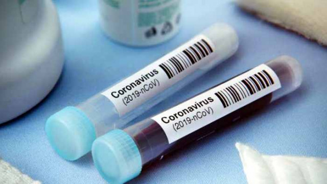 32 нови случая на COVID-19 у нас